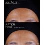 RENERGIE MULTILIFT CRX Triple Serum Retinol - 50ml