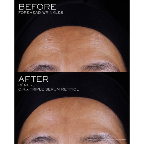 RENERGIE MULTILIFT CRX Triple Serum Retinol - 50ml